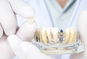 Closeup of dentist’s white-gloved hands showing sample dental implant