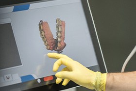 Dentist showing digital impressions to patient