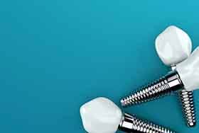 dental implants against a blue background