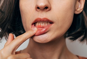 Woman at the dentist with tooth pain